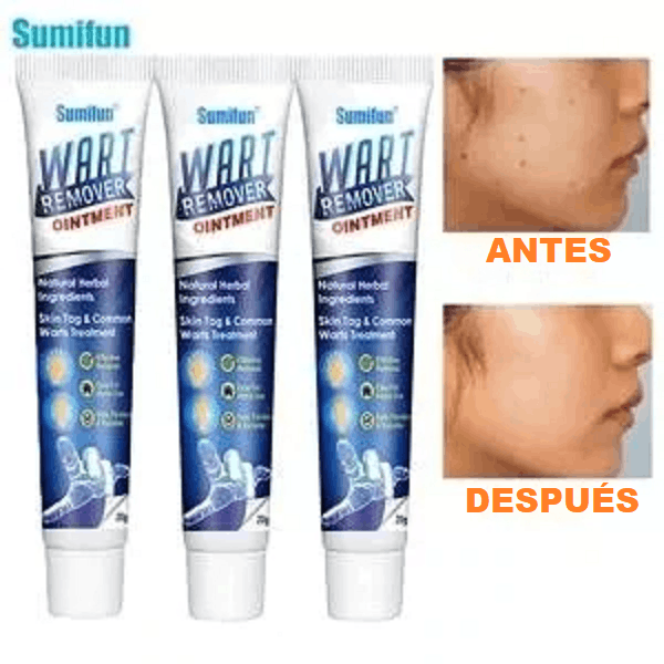 Crema WART CARE™ - REMOVEDOR DE VERRUGAS